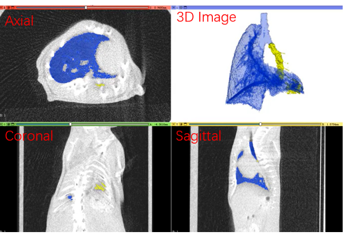 figure-protocol-7 CT scan analysis with axial, coronal, sagittal views; 3D lung imaging; medical diagnosis techniques.