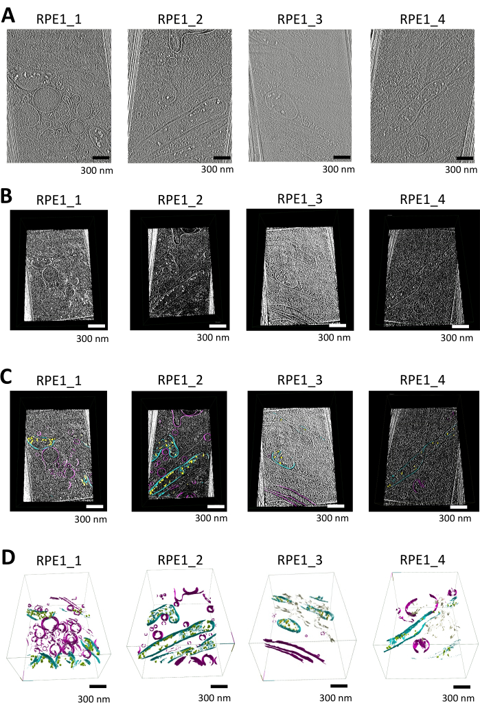 Cryo-electron tomography, cell ultrastructure, visual analysis; 2D, 3D tomographic slices; 300 nm scale.