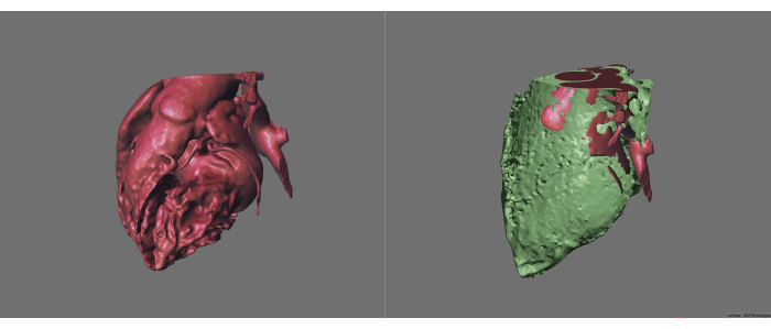 figure-results-2 3D heart model analysis; anatomy study; comparative visualization; structural diagram.