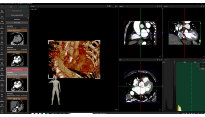 figure-results-5 CT scan analysis, medical imaging software interface, 3D model, cross-sectional slices, diagnostic tool.