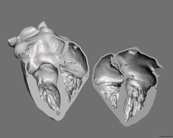 figure-results-10 3D heart model diagram; anatomical structure; educational use; medical study visualization.