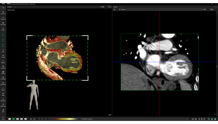 Mixed Reality Technology and Three-Dimensional Printing in Teaching ...