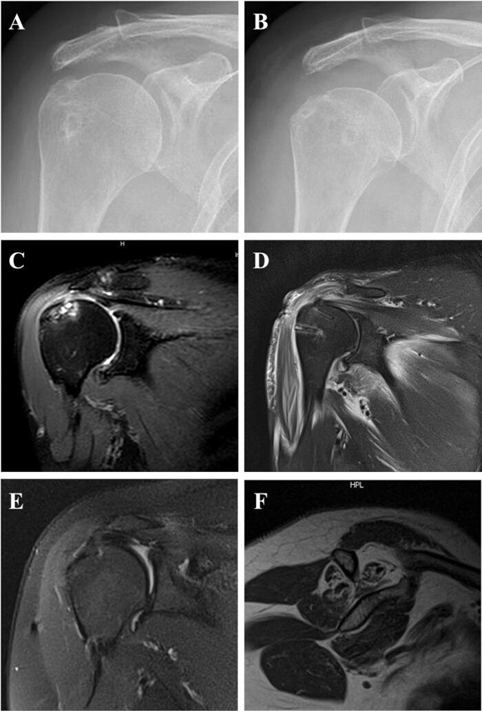 figure-results-2 Shoulder imaging; X-ray and MRI scans showing bone structure and soft tissue details for diagnosis.