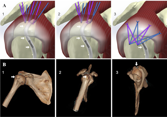 figure-results-3 Shoulder joint mechanics, tendon movement diagram, anatomical bone comparison, biomechanical study.