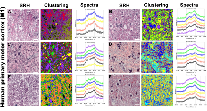 Multimodal Optical Imaging Platform for Studying Cellular Metabolism