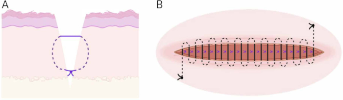 Surgical healing phases diagram with tension distribution analysis on wound closure.