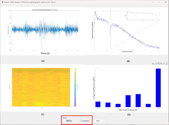 figure-protocol-18 Electroencephalographic signal analysis with time series, frequency plot, spectrogram, and bar chart.