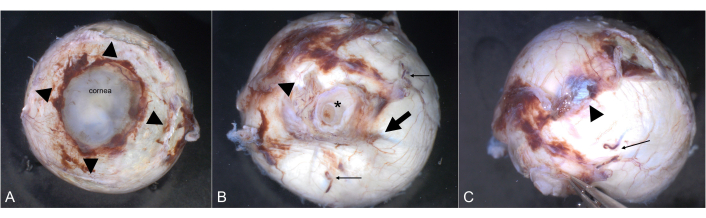 figure-results-2 显示角膜摘除的ocular解剖步骤示意图,用于眼球解剖学研究。