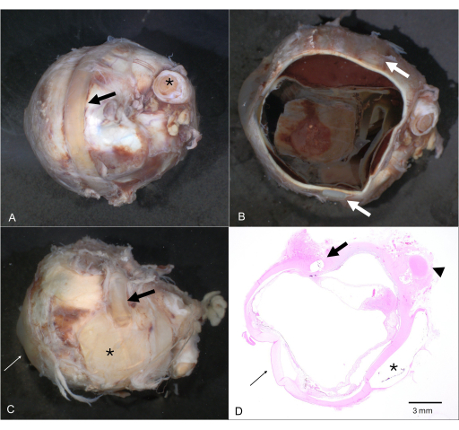 figure-results-4 显示眼部结构及肿瘤的组织学横截面;示意图;眼部解剖分析。
