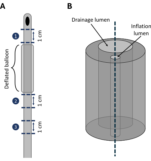 Balloon catheter design diagram showing inflation and drainage lumens, measurement markers.