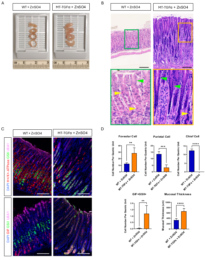figure-results-2 Zinc sulfate effect on gastric cells; histology and immunofluorescence images; WT vs. MT-TGFα analysis.