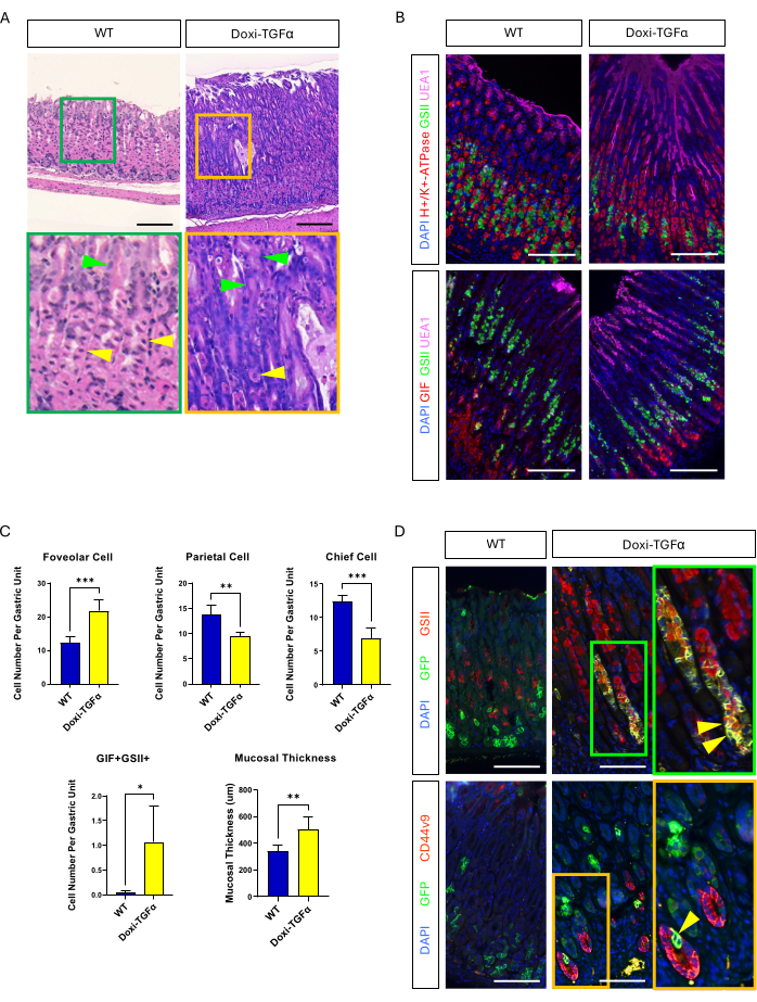 figure-results-4 Histological analysis of gastric tissues; WT vs. Dox-TGFα; includes graphs and fluorescence microscopy.