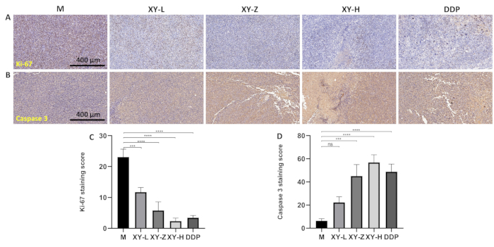 Ki-67 and Caspase 3 immunostaining images; staining score bar charts; cancer research analysis.