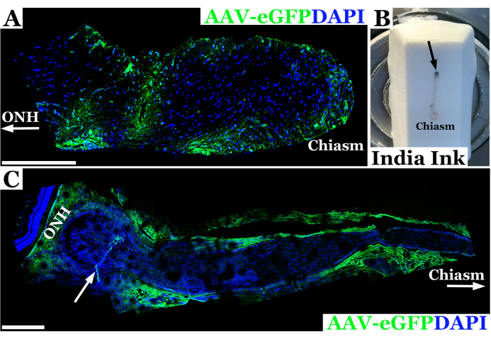 AAV-eGFP and DAPI staining in animal tissue sections; includes optic nerve head and chiasm analysis.
