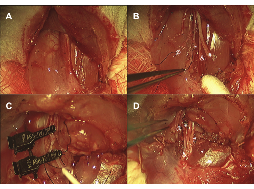figure-results-2 Surgical anatomy dissection showing tissue identification; labeled diagram of procedural steps.