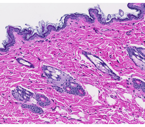 figure-results-5 Histology, dermal tissue section, microscope image; cellular structure, tissue layers, magnification.