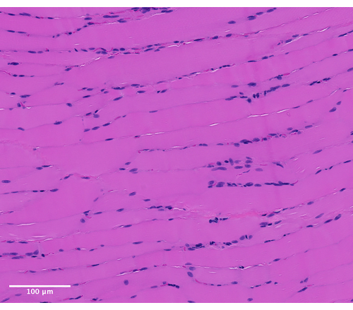 figure-results-6 Histology slide, muscle tissue, transverse striations, cellular structure, microscopy image, 100 μm scale.