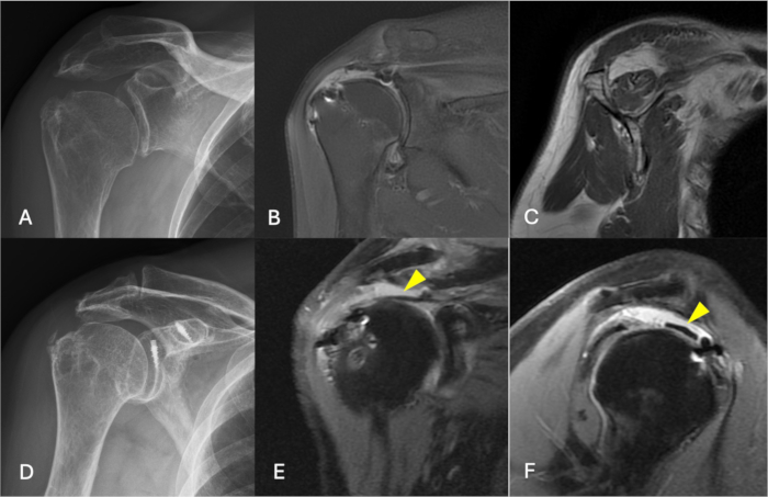 Shoulder MRI and X-ray showing joint imaging techniques for medical analysis and diagnosis.