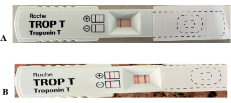 figure-results-6 Troponin T test strips showing positive and negative results; diagnostic test comparison.