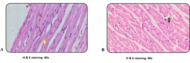 figure-results-8 Cardiac tissue microscopy, H&E stain, 40x magnification, cellular structure comparison diagram.
