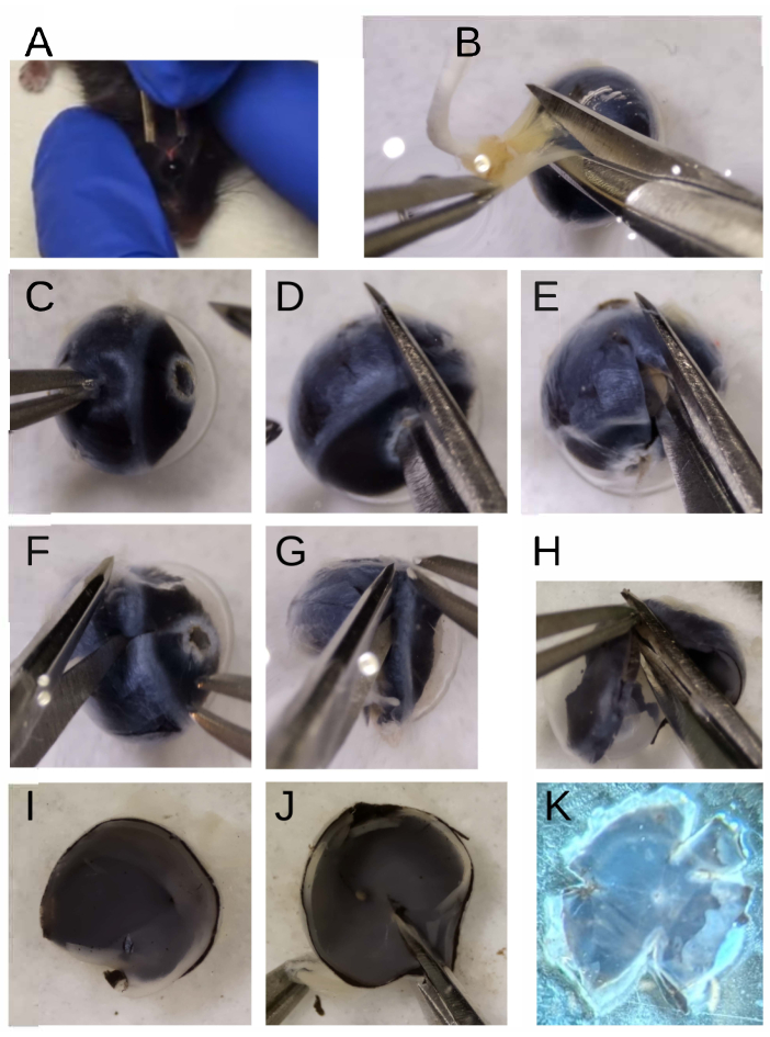 figure-results-3 Dissection process of mouse eye, step-by-step, using forceps in biological study.