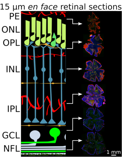 figure-results-7 En face retinal sections diagram; layers labeled PE, ONL, OPL; microscopic imaging results.