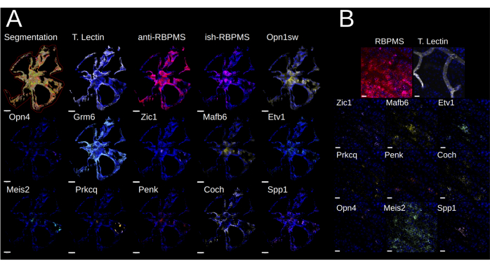 figure-results-8 Visualizing protein expression via fluorescence microscopy; segmentation, anti-RBPMS; diagram.