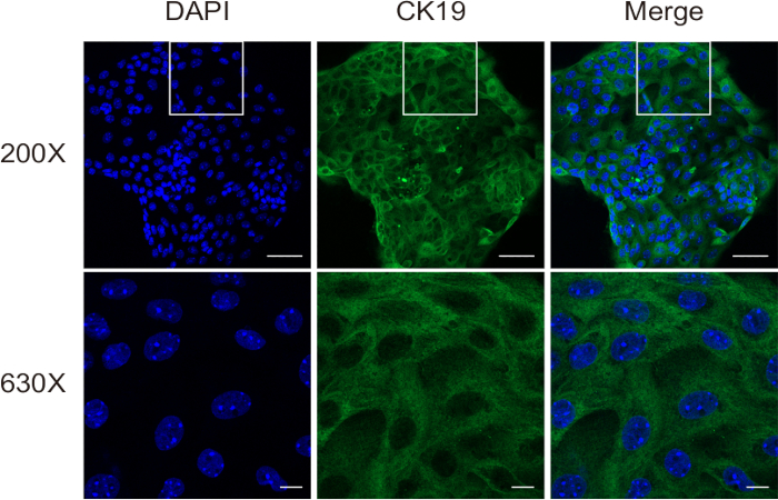 figure-results-4 Fluorescence microscopy, cell nuclei stained with DAPI, CK19 marker, merged images, magnifications 200X 630X.