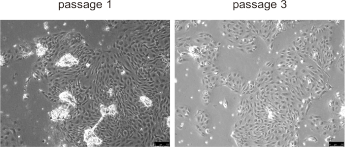 figure-results-5 Cell growth microscope image; passage 1 vs. passage 3 comparison; cell morphology study.