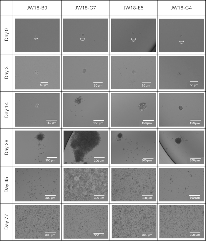 Cell growth over time; microscope images; cell proliferation; JW18 lines; 0 to 77 days; scale bars.