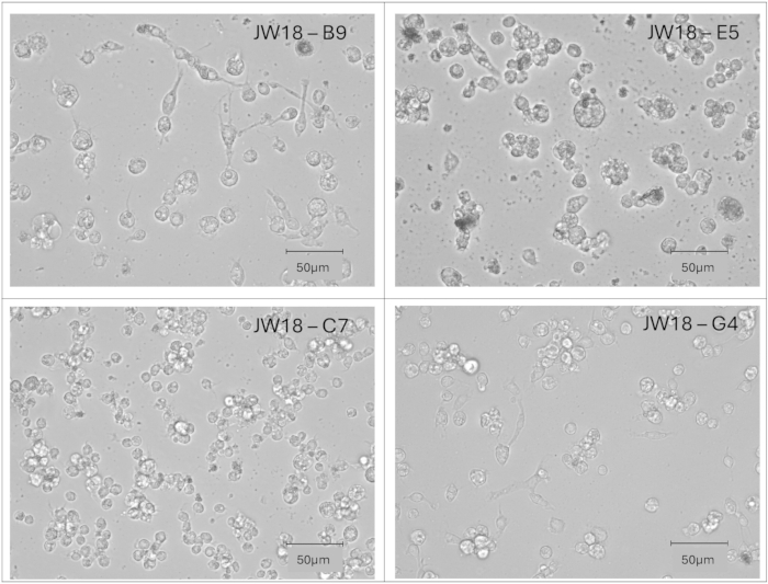 Cell morphology comparison, microscope image, 50µm scale, four samples marked JW18 B9/E5/C7/G4.