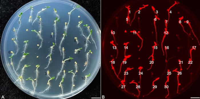Agrobacterium Microscope Agrobacterium Tumefaciens Colony Morphology