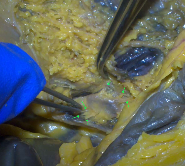 figure-results-5 Rat dissection, mesentery identification; anatomy lab, tissue exploration, educational diagram.