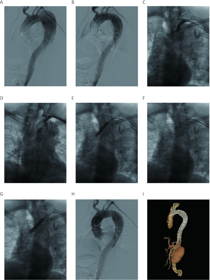 figure-results-1