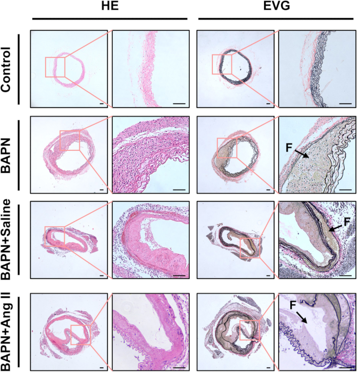 Histological analysis diagram; H&E vs EVG staining, vascular structure, treatment effects.