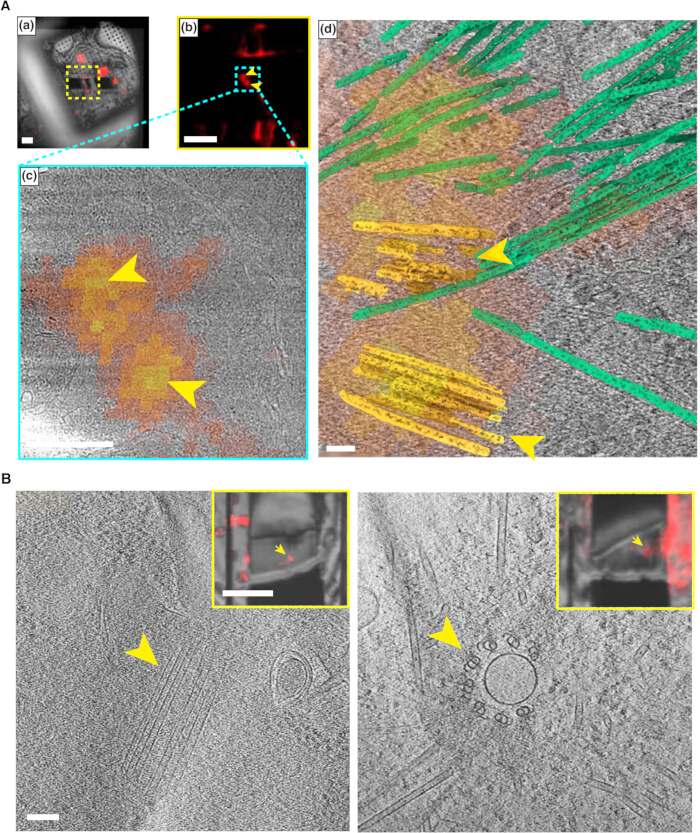 Electron microscopy diagrams of cellular structures with color-coded highlights for structural analysis.