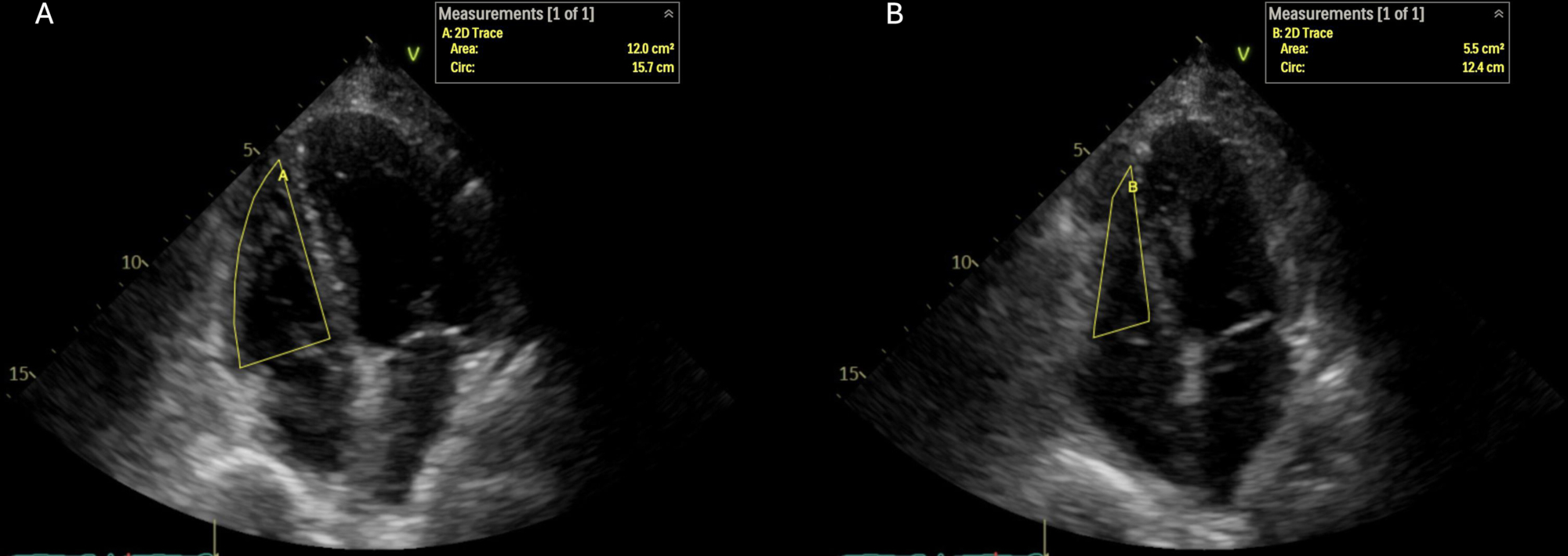 An Evidence-Based Echocardiographic Image Acquisition Protocol for ...