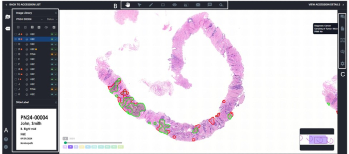 figure-results-5 Histology slide analysis highlights tissue sections, showing stained areas in a digital interface.