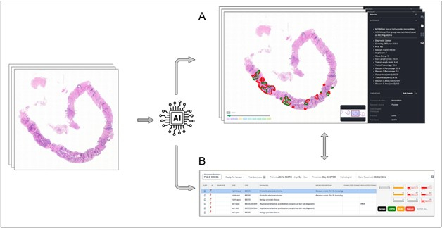 figure-results-7 Histology analysis diagram with AI integration process and results table for data examination.