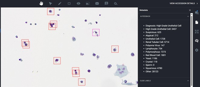 figure-results-8 Cell classification using AI in a microscopy image; highlights possible diagnostic indicators.