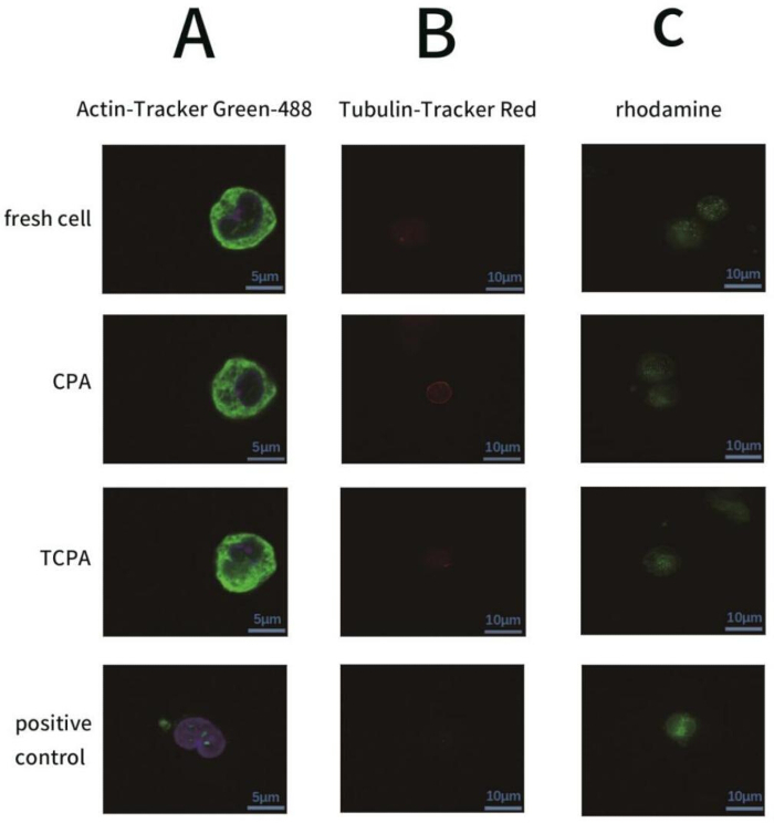 Fluorescence microscopy, cells labeled with Actin-Tracker Green-488, Tubulin-Tracker Red, rhodamine.