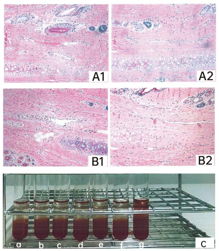 Histological sections A1-B2 and blood test tubes for tissue examination and analysis comparison.