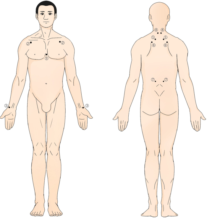 figure-results-2 Human body diagram illustrating acupuncture points for therapy visualization.