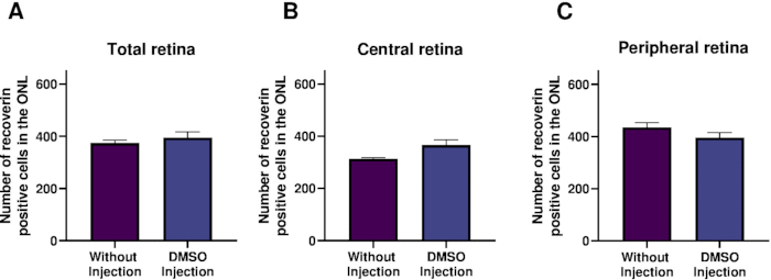 Retisite Tab Retinite Pigmentosa Antes E Depois