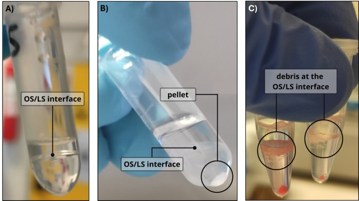 Centrifugation process; OS/LS interface, pellet formation in test tubes; separation experiment.