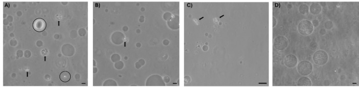 Microscopic images of vesicles showing size variations; magnified details in labeled sections A-D.