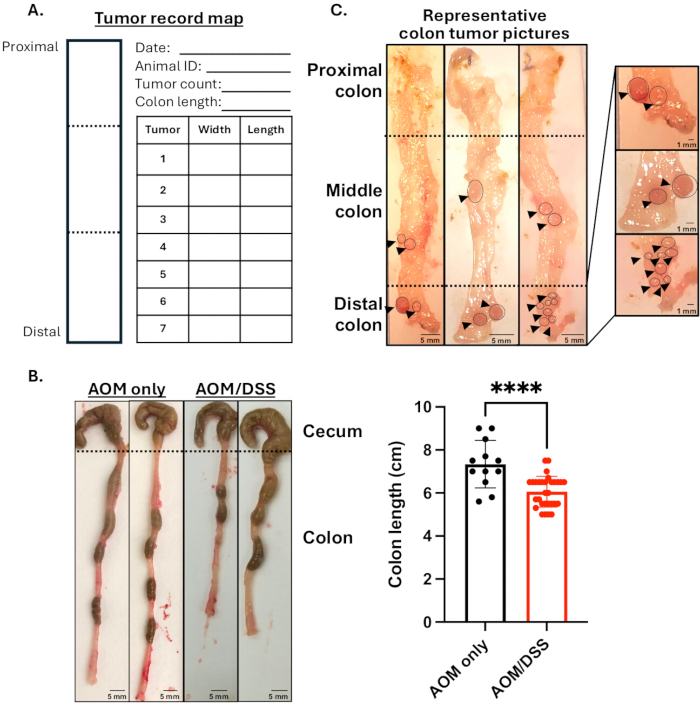 figure-results-3 Colon tumor analysis, diagram with tumor record map, specimen images, experiment results comparison.