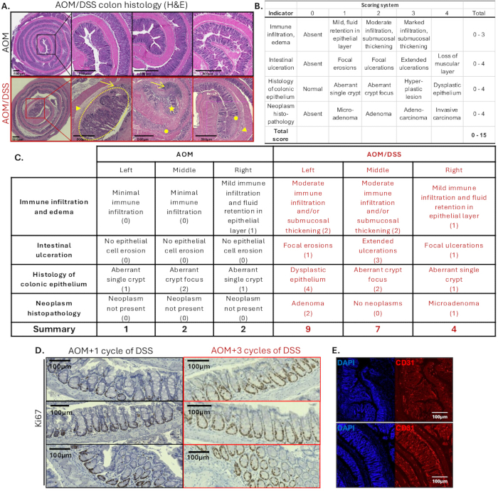 figure-results-4 AOM/DSS colon histology H&E results; indicators table; immunostaining analysis; microscopy images.