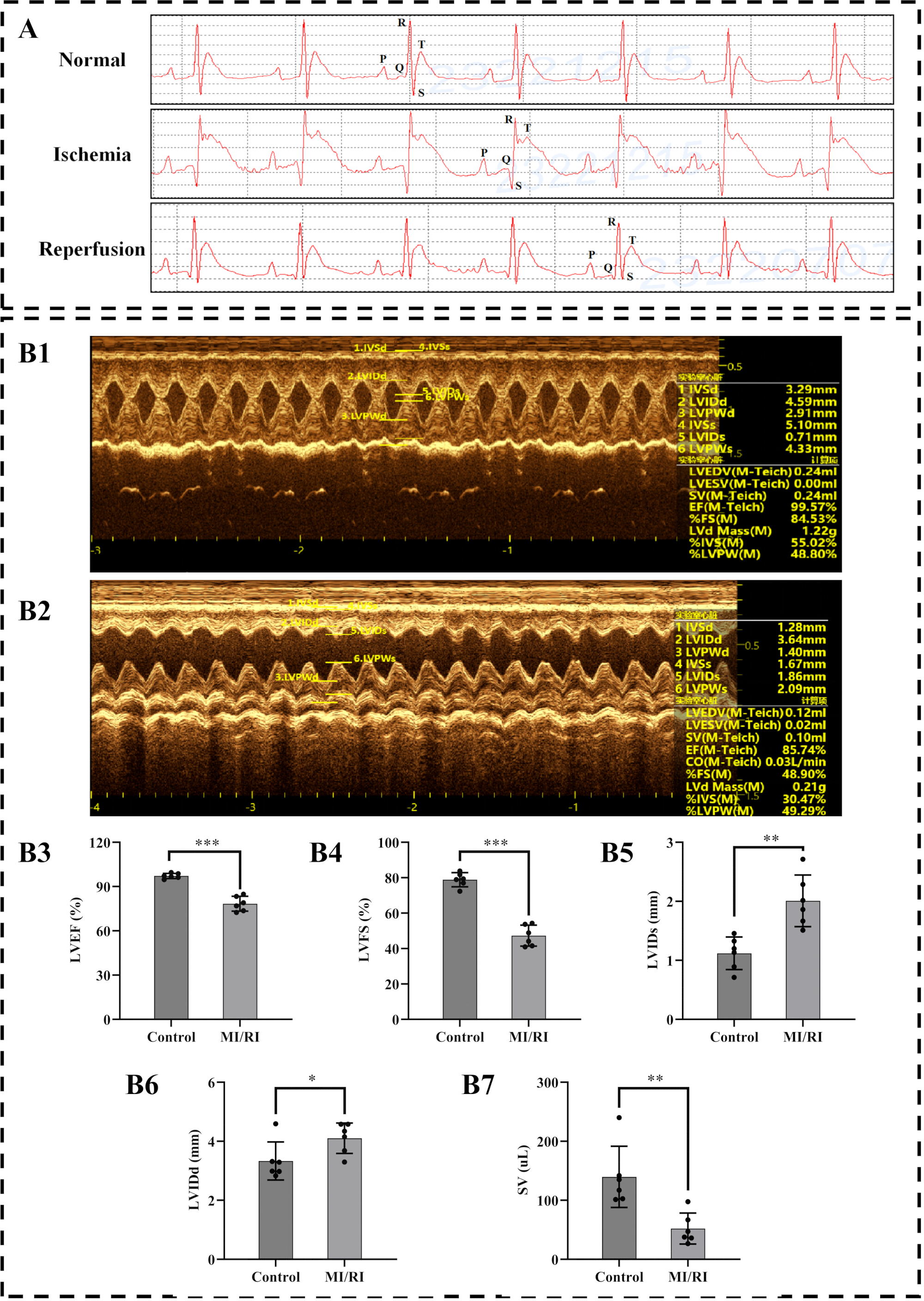 A Minimally Invasive Double Live-Knot Technique for Myocardial Ischemia ...