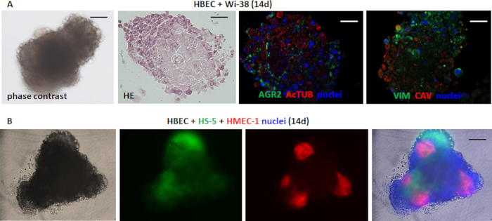 figure-results-3 HBEC cell culture phase contrast microscopy, histology, AGR2, ActTUB staining, nuclei visualization.